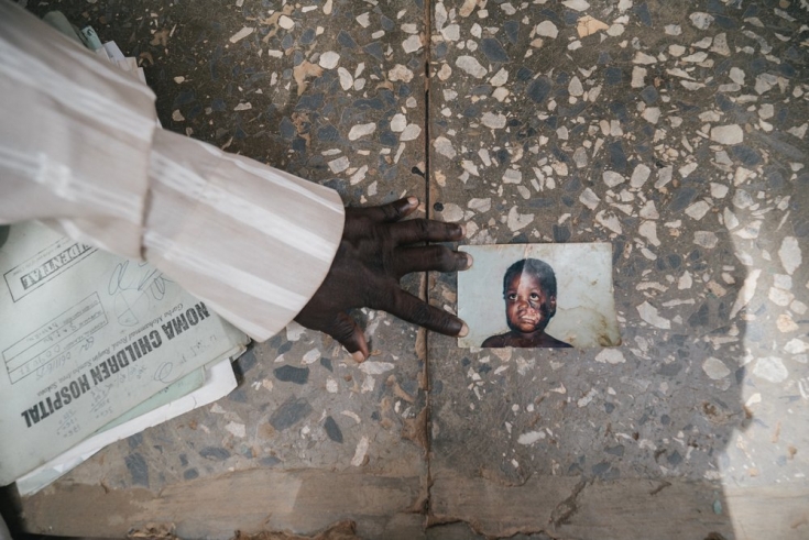 Fátima muestra una foto de cuando llegó al hospital de Sokoto con solo 5 años.